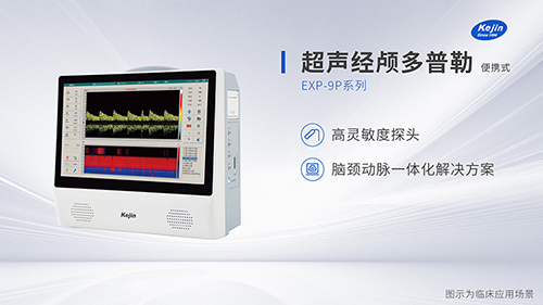 國產超聲經顱多普勒廠家
